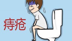 長(cháng)痔瘡怎么治療好