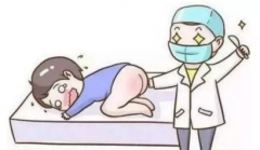 治療肛門(mén)瘙癢手術(shù)費用多少錢(qián)