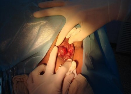 南寧哪個(gè)醫院治痔瘡更放心